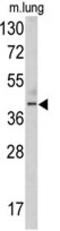 Thymine DNA Glycosylase antibody, AP17781PU-N, Origene, Western Blot image 