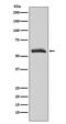 Cholinergic Receptor Muscarinic 3 antibody, M03150, Boster Biological Technology, Western Blot image 