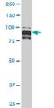 Interferon Gamma Inducible Protein 16 antibody, H00003428-M06, Novus Biologicals, Western Blot image 