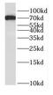 Dynein intermediate chain 2, axonemal antibody, FNab02438, FineTest, Western Blot image 