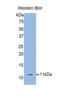 Collagen Type II Alpha 1 Chain antibody, LS-C373100, Lifespan Biosciences, Western Blot image 