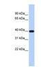 Phospholipid Phosphatase Related 5 antibody, NBP1-70670, Novus Biologicals, Western Blot image 