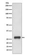 Major Histocompatibility Complex, Class II, DP Beta 1 antibody, M00487-1, Boster Biological Technology, Western Blot image 