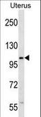 Zinc Finger SWIM-Type Containing 5 antibody, LS-C160975, Lifespan Biosciences, Western Blot image 