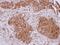 STIP1 Homology And U-Box Containing Protein 1 antibody, PA5-32046, Invitrogen Antibodies, Immunohistochemistry frozen image 