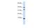 Diazepam Binding Inhibitor, Acyl-CoA Binding Protein antibody, GTX47770, GeneTex, Western Blot image 