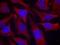 Synapsin I antibody, PA5-37749, Invitrogen Antibodies, Immunofluorescence image 