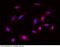 Mitogen-Activated Protein Kinase Kinase 6 antibody, 100954-T10, Sino Biological, Immunohistochemistry paraffin image 