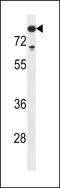 DNA nucleotidylexotransferase antibody, LS-C161789, Lifespan Biosciences, Western Blot image 