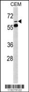 FKBP Prolyl Isomerase 10 antibody, 62-869, ProSci, Western Blot image 