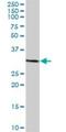 TBC1 Domain Family Member 7 antibody, H00051256-B01P, Novus Biologicals, Western Blot image 