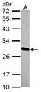HscB Mitochondrial Iron-Sulfur Cluster Cochaperone antibody, PA5-30693, Invitrogen Antibodies, Western Blot image 