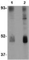 Wnt Family Member 10B antibody, ab70816, Abcam, Western Blot image 