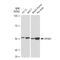 Eukaryotic Translation Initiation Factor 4A3 antibody, GTX03243, GeneTex, Western Blot image 