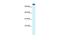 Kinesin Family Member 3C antibody, GTX47735, GeneTex, Western Blot image 