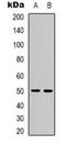 Protein Phosphatase 4 Regulatory Subunit 2 antibody, orb319037, Biorbyt, Western Blot image 