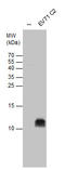 Enterovirus antibody, GTX132343, GeneTex, Western Blot image 