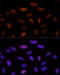 Activity Dependent Neuroprotector Homeobox antibody, 19-410, ProSci, Immunofluorescence image 