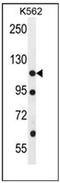 Epithelial Cell Transforming 2 Like antibody, AP51361PU-N, Origene, Western Blot image 