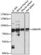 GTPase, IMAP Family Member 8 antibody, LS-C750185, Lifespan Biosciences, Western Blot image 