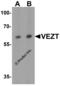 Vezatin, Adherens Junctions Transmembrane Protein antibody, 7959, ProSci, Western Blot image 