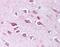 Tolloid Like 2 antibody, NBP1-44188, Novus Biologicals, Immunohistochemistry frozen image 