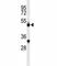 Complement Factor Properdin antibody, F52012-0.4ML, NSJ Bioreagents, Western Blot image 