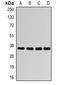 Aldo-Keto Reductase Family 1 Member C4 antibody, abx225023, Abbexa, Western Blot image 