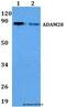 ADAM Metallopeptidase Domain 28 antibody, LS-C411972, Lifespan Biosciences, Western Blot image 