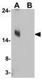Microtubule Associated Protein 1 Light Chain 3 Gamma antibody, GTX32125, GeneTex, Western Blot image 