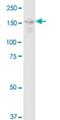 DOT1 Like Histone Lysine Methyltransferase antibody, H00084444-M01, Novus Biologicals, Western Blot image 