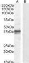 Forkhead Box I3 antibody, NBP1-72044, Novus Biologicals, Western Blot image 