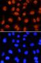 LIM Domains Containing 1 antibody, MAB8494, R&D Systems, Immunocytochemistry image 