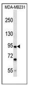 Fibronectin Type III And SPRY Domain Containing 2 antibody, AP51729PU-N, Origene, Western Blot image 