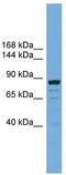 Autophagy Related 9B antibody, TA344178, Origene, Western Blot image 