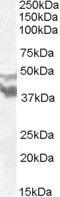 Dynein Axonemal Assembly Factor 4 antibody, PA5-18517, Invitrogen Antibodies, Western Blot image 