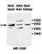 Adenylosuccinate Lyase antibody, orb77767, Biorbyt, Western Blot image 