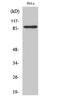 ELKL motif serine/threonine-protein kinase 3 antibody, STJ94014, St John