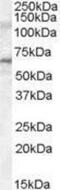 Interleukin 1 Receptor Associated Kinase 3 antibody, NB100-96912, Novus Biologicals, Western Blot image 