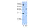 Eukaryotic Translation Initiation Factor 4H antibody, 29-458, ProSci, Enzyme Linked Immunosorbent Assay image 