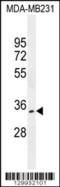 OTU Deubiquitinase 6A antibody, 56-163, ProSci, Western Blot image 