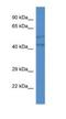 Transmembrane Protein 102 antibody, NBP1-74231, Novus Biologicals, Western Blot image 