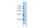 Methyltransferase Like 1 antibody, GTX46207, GeneTex, Western Blot image 