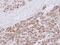 Proteasome 20S alpha 3 antibody, NBP1-33537, Novus Biologicals, Immunohistochemistry paraffin image 