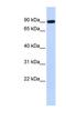 HECT Domain E3 Ubiquitin Protein Ligase 2 antibody, NBP1-55080, Novus Biologicals, Western Blot image 