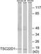 TSC22 Domain Family Member 1 antibody, TA312827, Origene, Western Blot image 