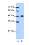 Heterogeneous Nuclear Ribonucleoprotein F antibody, NBP1-57273, Novus Biologicals, Western Blot image 