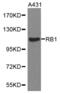 RB Transcriptional Corepressor 1 antibody, abx001728, Abbexa, Western Blot image 