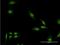 Early Endosome Antigen 1 antibody, H00008411-M03, Novus Biologicals, Immunocytochemistry image 