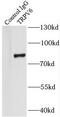 Transient Receptor Potential Cation Channel Subfamily V Member 6 antibody, FNab09030, FineTest, Immunoprecipitation image 